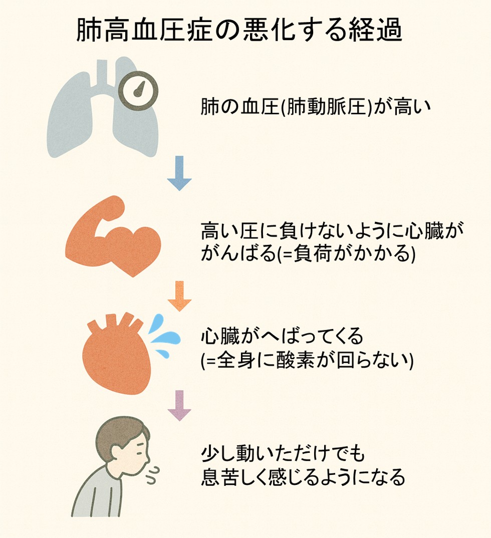 図は肺高血圧の悪化する経過を示す