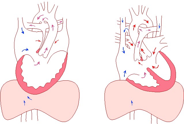 無脾症候群（指定難病189） – 難病情報センター