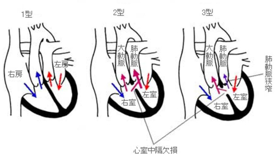 炎 難病 血管