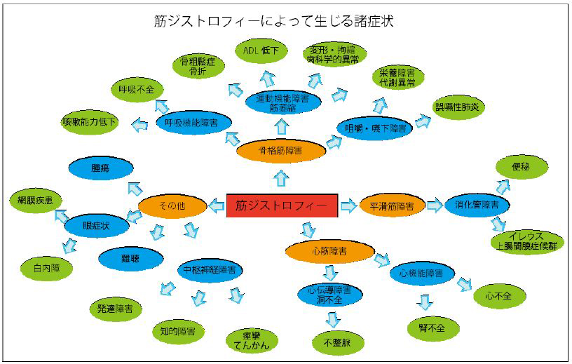 筋ジストロフィー（指定難病１１３） – 難病情報センター