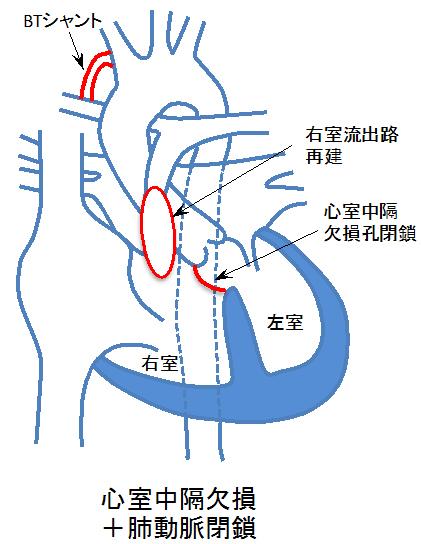 この病気はどういう経過をたどるのですか。