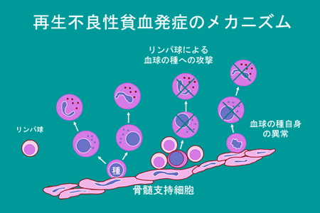 図1　再生不良性貧血の病態