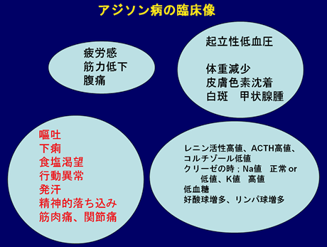 図：アジソン病の症状と検査所見